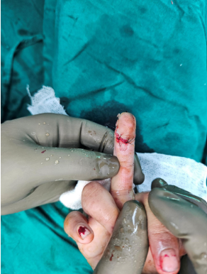 Doctor examining hand injury