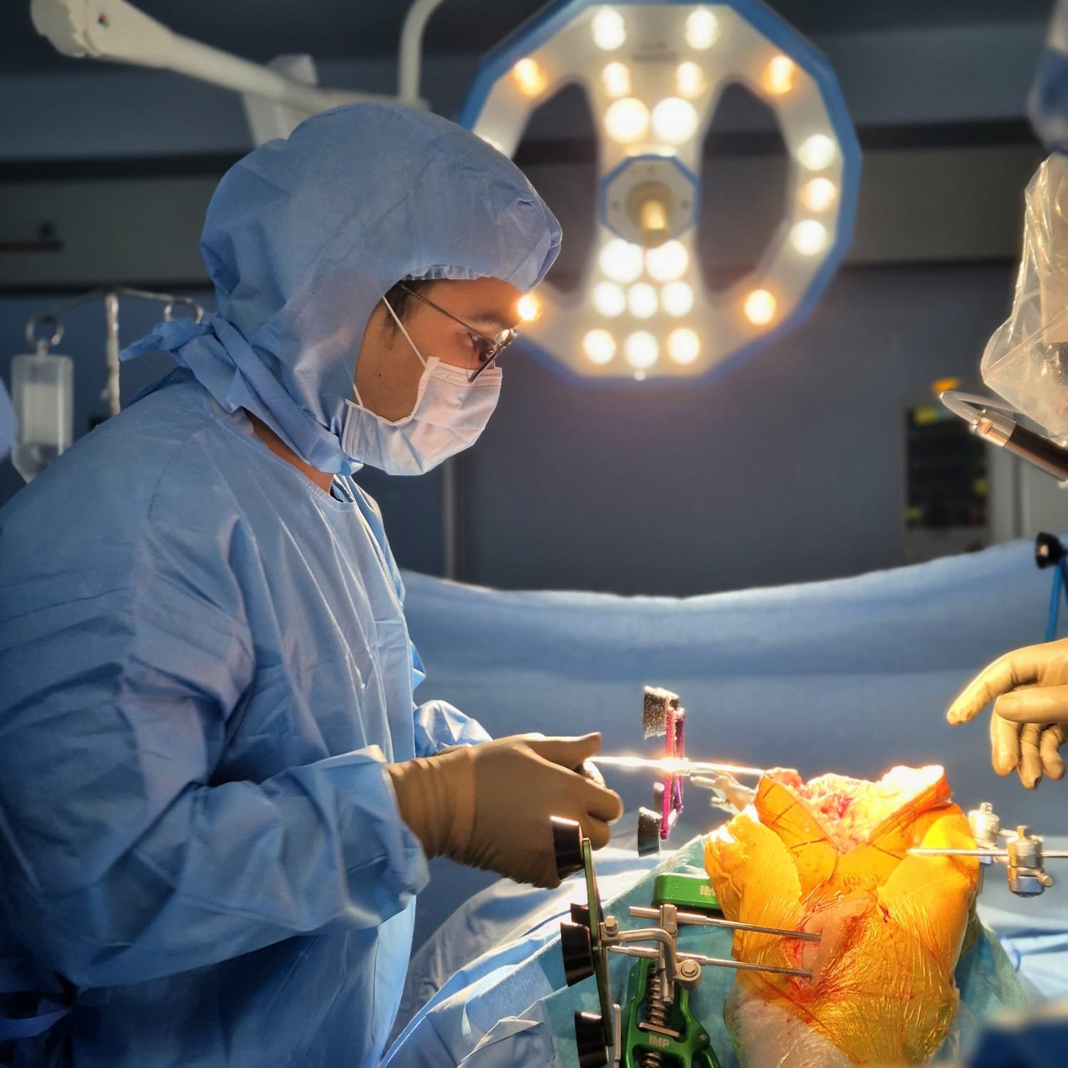 Robotic Knee Arthroplasty